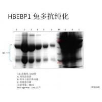 蛋白AG抗体纯化试剂盒 Protein AG Antibody Purification Kit