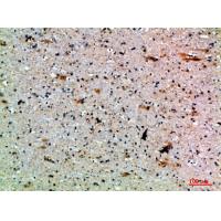 APRIL Polyclonal Antibody