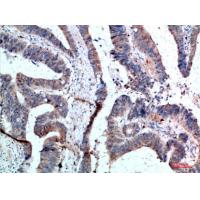 APRIL Polyclonal Antibody