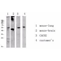 Akt antibody