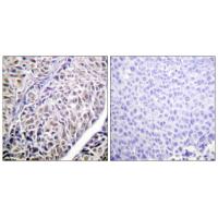 ARK-2 Polyclonal Antibody