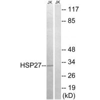 HSP27 Polyclonal Antibody