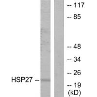 HSP27 Polyclonal Antibody