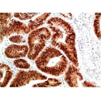 HSP40 Rabbit Polyclonal Antibody