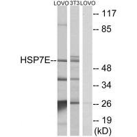 HSP60 Polyclonal Antibody