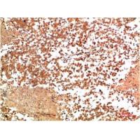 HSP90-α Rabbit Polyclonal Antibody