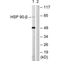 HSP90-β Polyclonal Antibody