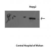 Stat1 Polyclonal Antibody