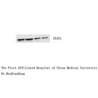 Stat1 Polyclonal Antibody