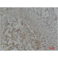 Stat1 Polyclonal Antibody