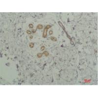 STAT2 Polyclonal Antibody