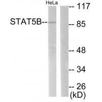 Stat5 Polyclonal Antibody