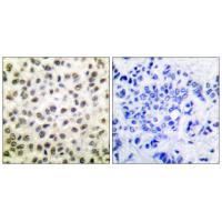 Stat5 Polyclonal Antibody