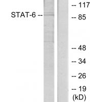 Stat6 Polyclonal Antibody