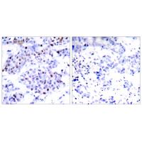 Stat6 Polyclonal Antibody