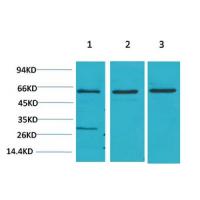 Akt2 Polyclonal Antibody