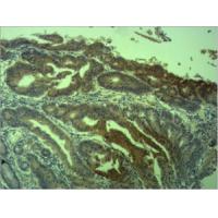 Survivin Polyclonal Antibody