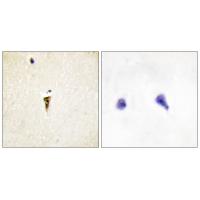 ICK Polyclonal Antibody