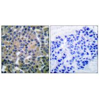 Syk Polyclonal Antibody