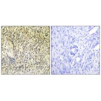 Syk Polyclonal Antibody