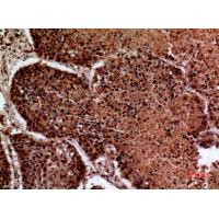 IFN-γRα Polyclonal Antibody