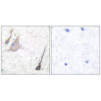 Synuclein-α Polyclonal Antibody