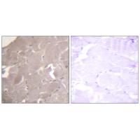 IKKα/β Polyclonal Antibody