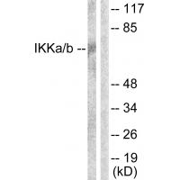 IKKα/β Polyclonal Antibody