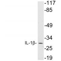 IL-1β Polyclonal Antibody