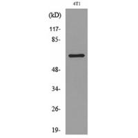 Amphiphysin II Polyclonal Antibody