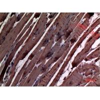 α-SMA Polyclonal Antibody