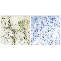 FoxI1 Polyclonal Antibody