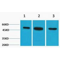 β II Tubulin Polyclonal Antibody