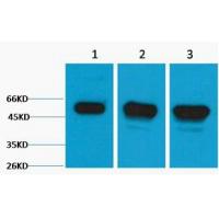 β III Tubulin Polyclonal Antibody