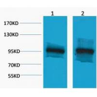 β-Catenin Polyclonal Antibody