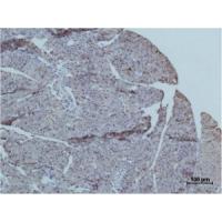 TRIM72 Polyclonal Antibody