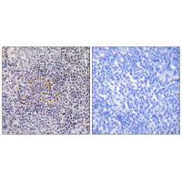 XRCC3 Polyclonal Antibody