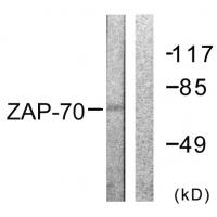 ZAP-70 Polyclonal Antibody