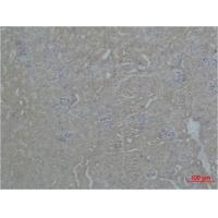 ZBTB45 Polyclonal Antibody