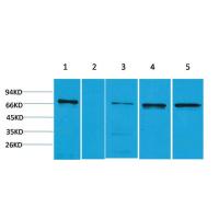 ZBTB45 Polyclonal Antibody