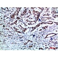 Vimentin Polyclonal Antibody