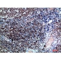 Vimentin Polyclonal Antibody