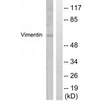 Vimentin Polyclonal Antibody