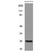 TNF-α Polyclonal Antibody