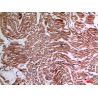 TNF-α Polyclonal Antibody