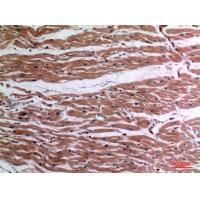 TNF-α Polyclonal Antibody