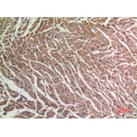 TNF-α Polyclonal Antibody