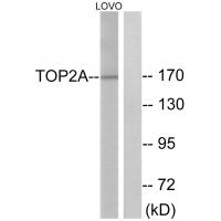 Topo IIα Polyclonal Antibody