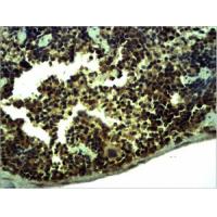 TLR1 Polyclonal Antibody