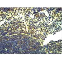 TLR2 Polyclonal Antibody